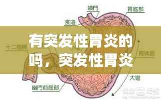 有突发性胃炎的吗,突发性胃炎要几天能好?