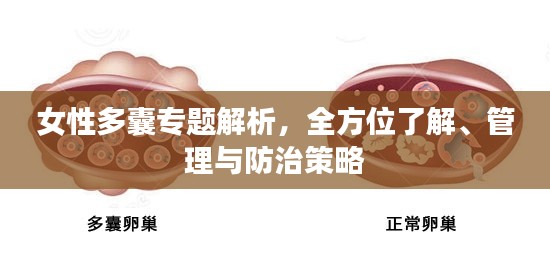 女性多囊专题解析,全方位了解、管理与防治策略